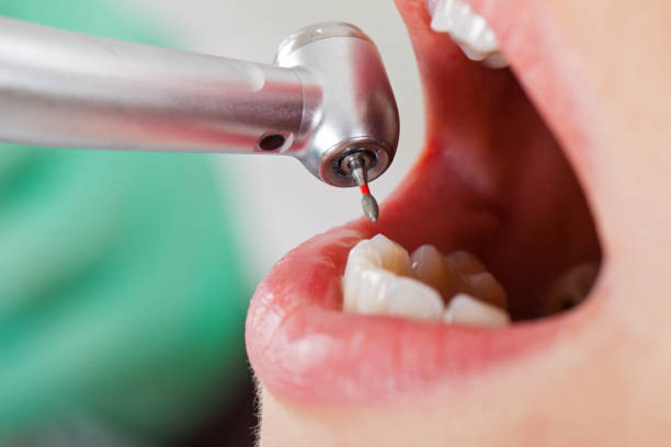 Best Emergency Dental Surgery in Huntertown, IN